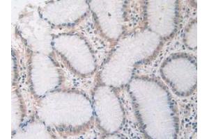 Figure. (SIRT4 Antikörper  (AA 28-314))