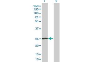Western Blot analysis of IFNA8 expression in transfected 293T cell line by IFNA8 MaxPab polyclonal antibody. (IFNA8 Antikörper  (AA 1-189))