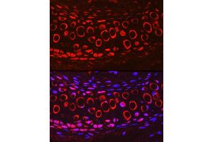Immunofluorescence analysis of Mouse cartilage using COMP Rabbit pAb (ABIN6127650, ABIN6138864, ABIN6138866 and ABIN6221502) at dilution of 1:200 (40x lens). (COMP Antikörper  (AA 20-160))