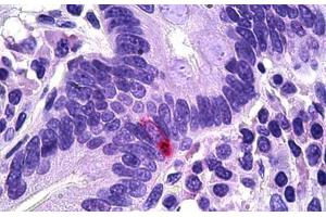 Human Intestine, Neuroendocrine Cells: Formalin-Fixed, Paraffin-Embedded (FFPE) (PPY Antikörper  (AA 61-73))