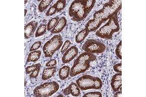 Immunohistochemical staining of human stomach with NSUN6 polyclonal antibody  shows strong granular cytoplasmic positivity in glandular cells at 1:10-1:20 dilution. (NSUN6 Antikörper)