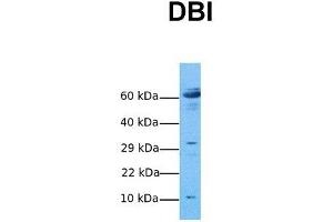 Host:  Rabbit  Target Name:  DBI  Sample Tissue:  Human Ovary Tumor  Antibody Dilution:  1.
