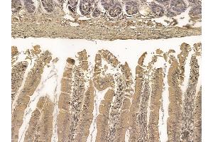 Cingulin Mouse Monoclonal Antibody at 1/100 staining rat colorectal tissue by IHC-P. (Cingulin Antikörper)