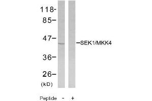 Image no. 2 for anti-Mitogen-Activated Protein Kinase Kinase 4 (MAP2K4) (Ser80) antibody (ABIN197325) (MAP2K4 Antikörper  (Ser80))