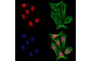 ABIN6254860 and ABIN6267065 staining H2O2 treated Hela cells by IF/ICC. (Histone 3 Antikörper  (H3K18ac))