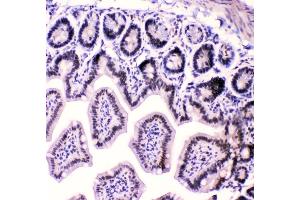 IHC analysis of HnRNPF using anti-HnRNPF antibody (ABIN4886622). (HNRNPF Antikörper  (N-Term))