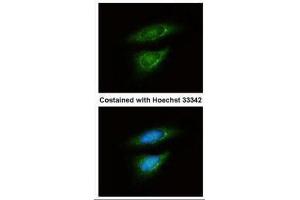 ICC/IF Image Immunofluorescence analysis of methanol-fixed HeLa, using LDH-B, antibody at 1:50 dilution. (LDHB Antikörper)