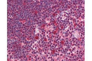 Anti-SNW1 antibody IHC of human thymus. (SNW1 Antikörper  (C-Term))