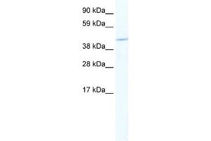 WB Suggested Anti-MEF2C Antibody Titration:  2. (MEF2C Antikörper  (N-Term))
