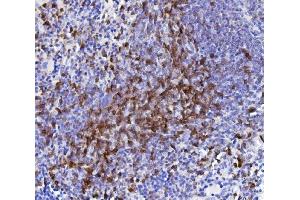 IHC analysis of CD5 using anti-CD5 antibody (ABIN7600841). (CD5 Antikörper  (AA 24-494))