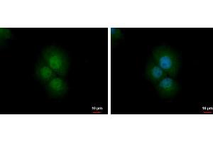 ICC/IF Image PRMT2 antibody detects PRMT2 protein at nucleus and cytoplasm by immunofluorescent analysis. (PRMT2 Antikörper)