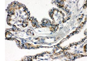 Immunohistochemistry (Paraffin-embedded Sections) (IHC (p)) image for anti-BCL2-Interacting Killer (Apoptosis-Inducing) (BIK) (AA 1-123) antibody (ABIN3043509)