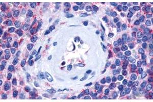 Anti-P2RY13 / P2Y13 antibody  ABIN1049209 IHC staining of human spleen. (Purinergic Receptor P2Y, G-Protein Coupled, 13 (P2RY13) (Cytoplasmic Domain) Antikörper)