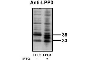 Image no. 1 for anti-Phosphatidic Acid Phosphatase Type 2B (PPAP2B) antibody (ABIN265045)
