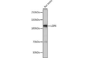 Western blot analysis of extracts of Rat testis, using LGR6 Rabbit mAb (ABIN7268235) at 1:1000 dilution. (LGR6 Antikörper)