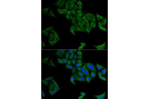 Immunofluorescence (IF) image for anti-SMYD Family Member 5 (SMYD5) antibody (ABIN1882323) (SMYD5 Antikörper)