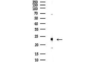 Western blot analysis of lysates from COLO205 cells(heat-shock,45 min treatment), using PARK7 Antibody at 1/1000 dilution.