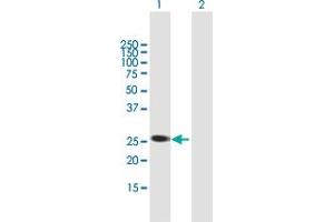 Western Blot analysis of AGPAT1 expression in transfected 293T cell line by AGPAT1 MaxPab polyclonal antibody. (AGPAT1 Antikörper  (AA 1-283))