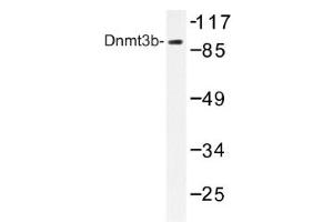 Image no. 1 for anti-DNA (Cytosine-5-)-Methyltransferase 3 beta (DNMT3B) antibody (ABIN317617) (DNMT3B Antikörper)