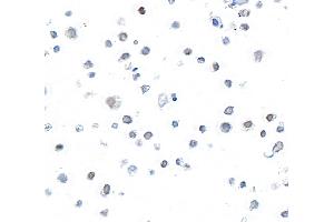 Immunocytochemistry (ICC) image for anti-V-Myb Myeloblastosis Viral Oncogene Homolog (Avian) (MYB) (AA 1-50) antibody (ABIN7795807) (Rekombinanter MYB Antikörper  (AA 1-50))