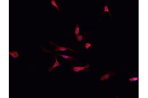Immunofluorescence (fixed cells) (IF/ICC) image for anti-Dihydropyrimidine Dehydrogenase (DPYD) (Internal Region) antibody (ABIN6261361)