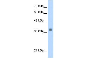 WB Suggested Anti-LDB1 Antibody Titration:  0. (LIM Domain Binding 1 Protein Antikörper  (C-Term))