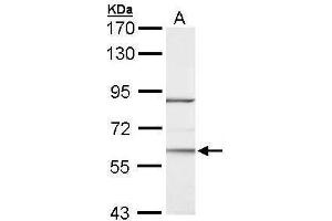WB Image Sample (30 ug of whole cell lysate) A: Hela 7. (RORA Antikörper)