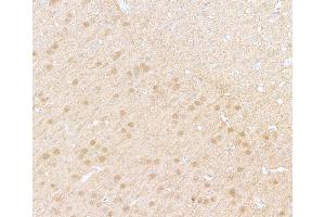Immunohistochemistry (IHC) image for anti-Ubiquitin Carboxyl-terminal Esterase L1 (Ubiquitin Thiolesterase) (UCHL1) (AA 50-100) antibody (ABIN7449527) (Rekombinanter UCHL1 Antikörper  (AA 50-100))