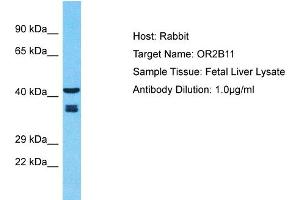Host: Rabbit Target Name: OR2B11 Sample Type: Fetal Liver lysates Antibody Dilution: 1. (OR2B11 Antikörper  (C-Term))