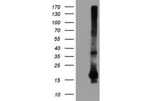 Western Blotting (WB) image for anti-Spermidine/Spermine N1-Acetyltransferase 2 (SAT2) antibody (ABIN1500807)