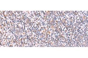 Immunohistochemistry of paraffin-embedded Human tonsil tissue using ITPKC Polyclonal Antibody at dilution of 1:40(x200) (ITPKC Antikörper)