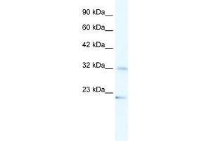 WB Suggested Anti-ZNF265 Antibody Titration:  1. (ZNF265 Antikörper  (N-Term))