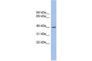 WB Suggested Anti-GLI4 Antibody Titration: 0. (GLI4 Antikörper  (N-Term))