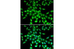 Immunofluorescence analysis of A549 cells using SERPINA10 antibody (ABIN6292722). (SERPINA10 Antikörper)