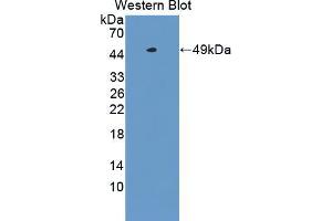 Western blot analysis of the recombinant protein. (TSPO Antikörper  (AA 1-169))