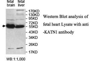 Image no. 1 for anti-Katanin P60 (ATPase Containing) Subunit A 1 (KATNA1) antibody (ABIN1577431)