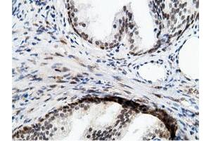 Image no. 15 for anti-EPM2A (Laforin) Interacting Protein 1 (EPM2AIP1) antibody (ABIN1498047) (EPM2AIP1 Antikörper)