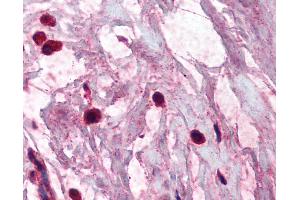 Anti-TPSAB1 / Mast Cell Tryptase antibody IHC of human breast, mast cells. (TPSAB1 Antikörper)