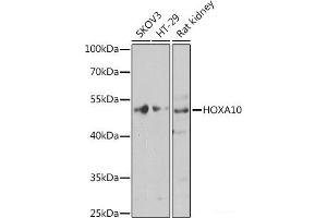 Western blot analysis of extracts of various cell lines using HOXA10 Polyclonal Antibody at dilution of 1:1000. (HOXA10 Antikörper)