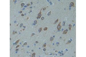 Used in DAB staining on fromalin fixed paraffin- embedded brain tissue (CNTNAP5 Antikörper  (AA 25-302))