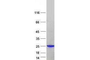 Validation with Western Blot (ARL2 Protein (Myc-DYKDDDDK Tag))