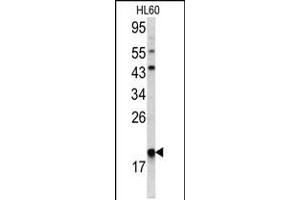 Western blot analysis of ARPC3 antibody in HL60 cell line lysates(35ug/lane) (ARPC3 Antikörper  (C-Term))