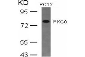 Image no. 3 for anti-Protein Kinase C, delta (PKCd) (AA 643-647) antibody (ABIN197565) (PKC delta Antikörper  (AA 643-647))