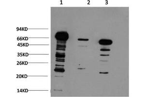 Western Blotting (WB) image for anti-Ubiquitin (Ubiquitin) antibody (ABIN5958540) (Ubiquitin Antikörper)