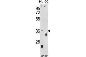 Western blot analysis of anti-TNFRSF14 Antibody (Center) Pab pre-incubated without(lane 1) and with (lane 2) blocking peptide in HL-60 cell line lysate.