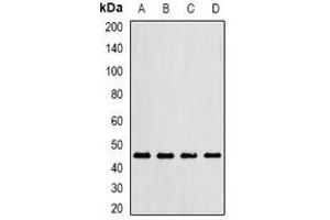 Western blot analysis of Gastric Lipase expression in MCF7 (A), mouse lung (B), mouse liver (C), rat kidney (D) whole cell lysates. (LIPF Antikörper)