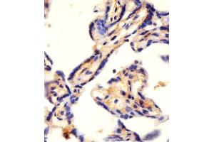 Antibody staining CAD in human placenta tissue sections by Immunohistochemistry (IHC-P - paraformaldehyde-fixed, paraffin-embedded sections).