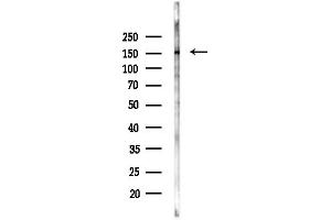 anti-Mitogen-Activated Protein Kinase Kinase Kinase 5 (MAP3K5) (pSer966) antibody