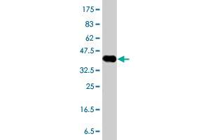 Western Blot detection against Immunogen (38. (RASGRP3 Antikörper  (AA 581-690))