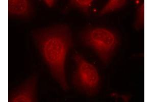 Immunofluorescence staining of methanol-fixed Hela cells using HDAC8(Phospho-Ser39) Antibody. (HDAC8 Antikörper  (pSer39))